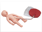 M186-3:Fetus (Delivery) (with placenta)