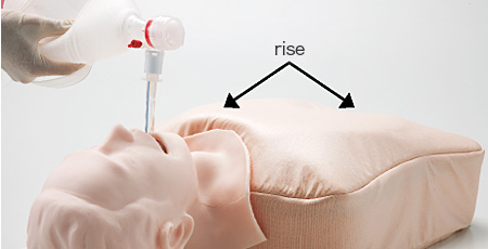 Confirmation of Mistakenly Intubated Air Possible