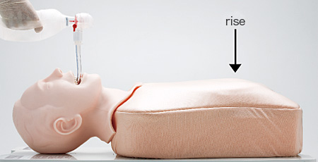 Confirmation of Mistakenly Intubated Air Possible