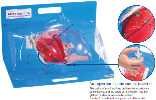 Clear 3D Model of Gluteal Injection Site